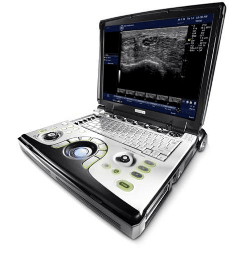 Black-housed GE LOGIQ e portable ultrasound, BT'12 redesign