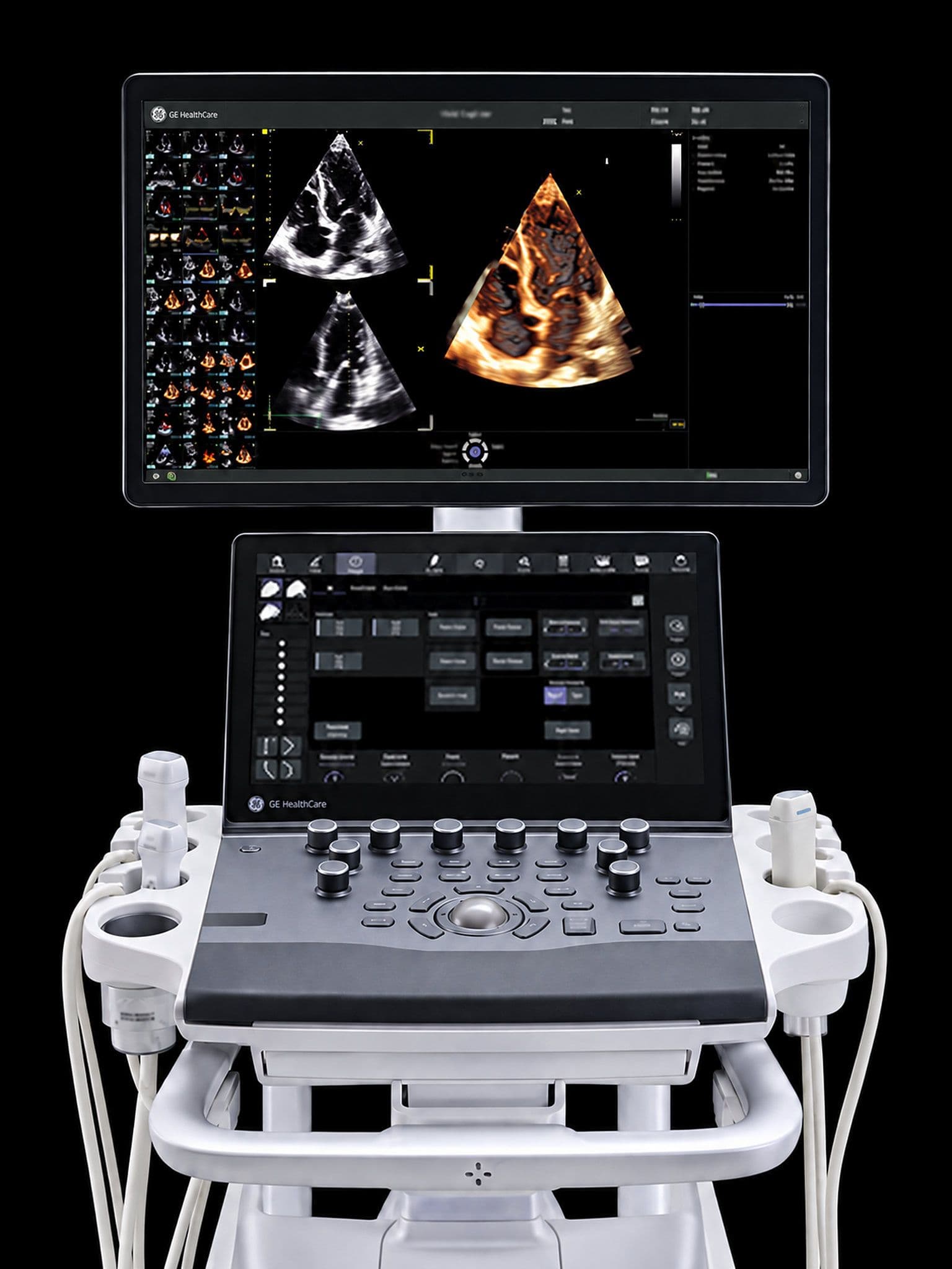 Cart-based cardiovascular ultrasound console with a widescreen monitor showing 2D and 4D cardiac images above a touch panel and control panel