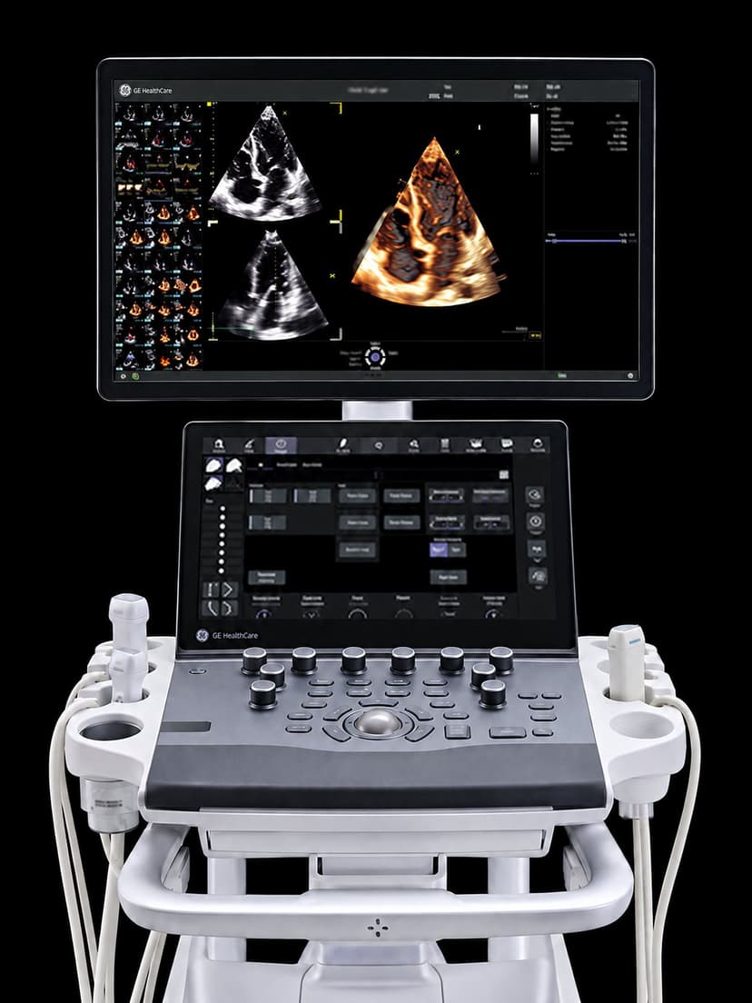 Cart-based cardiovascular ultrasound console with a widescreen monitor showing 2D and 4D cardiac images above a touch panel and control panel