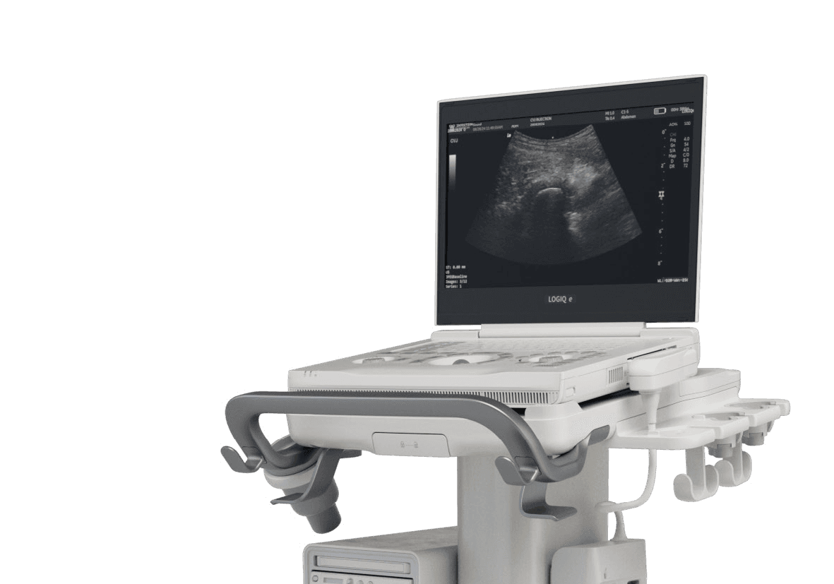 GE LOGIQ e S portable ultrasound system on cart