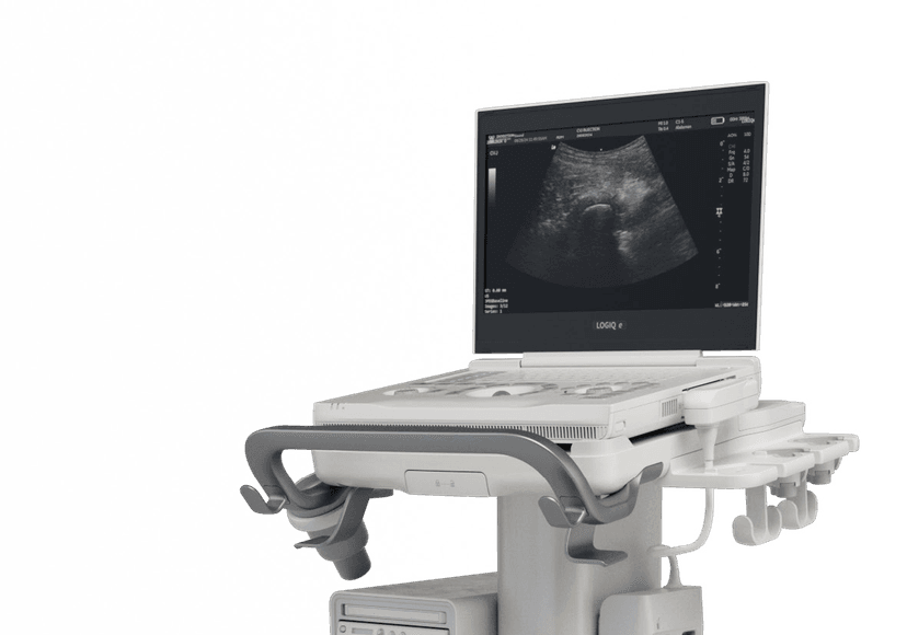GE LOGIQ e S portable ultrasound system on cart