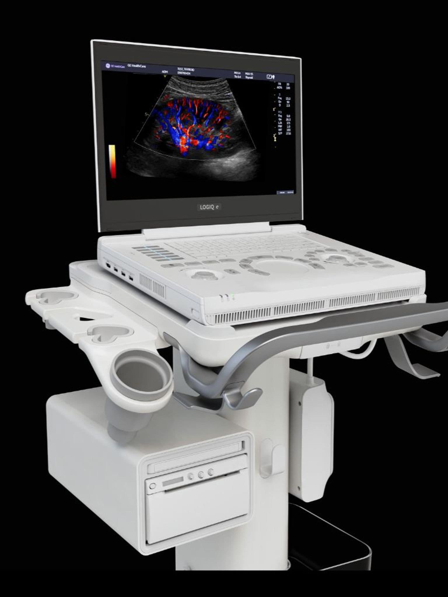 GE LOGIQ e ultrasound system