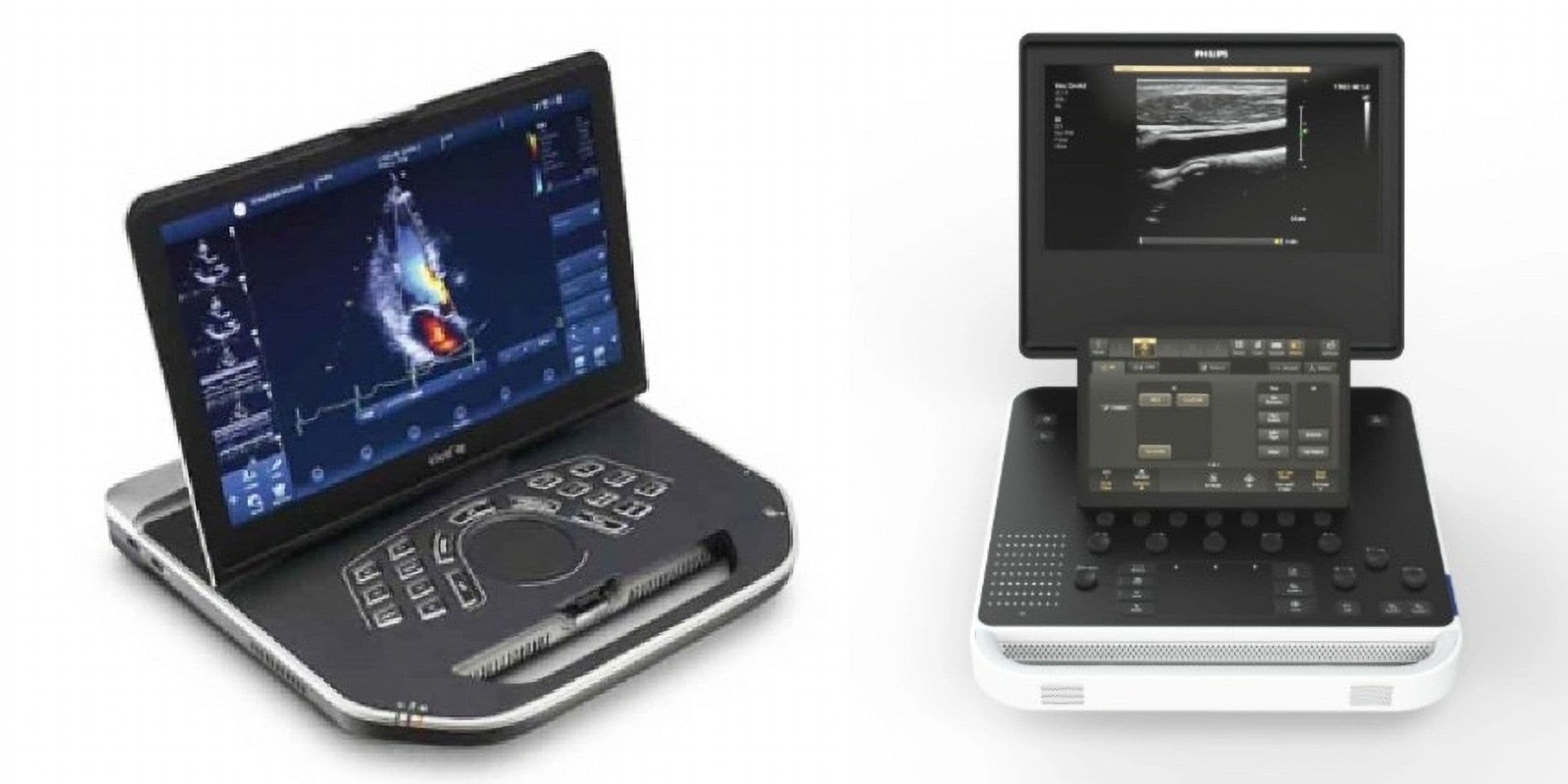Comparing GE Vivid iq and Philips 5000 Series Ultrasound: Which One is Right for You?