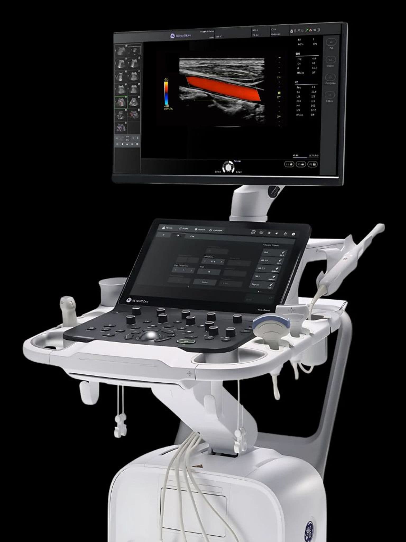 GE Versana Premier ultrasound system