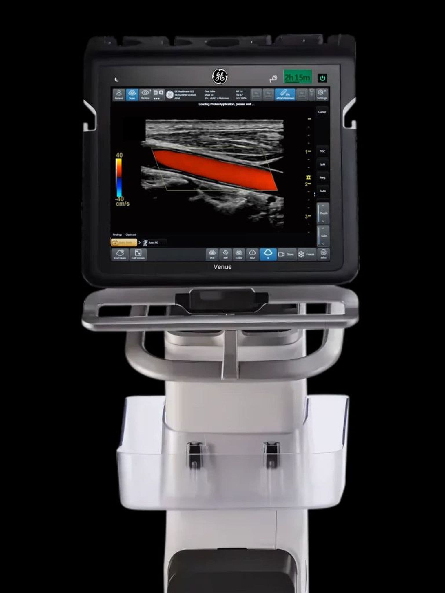 GE Venue ultrasound system