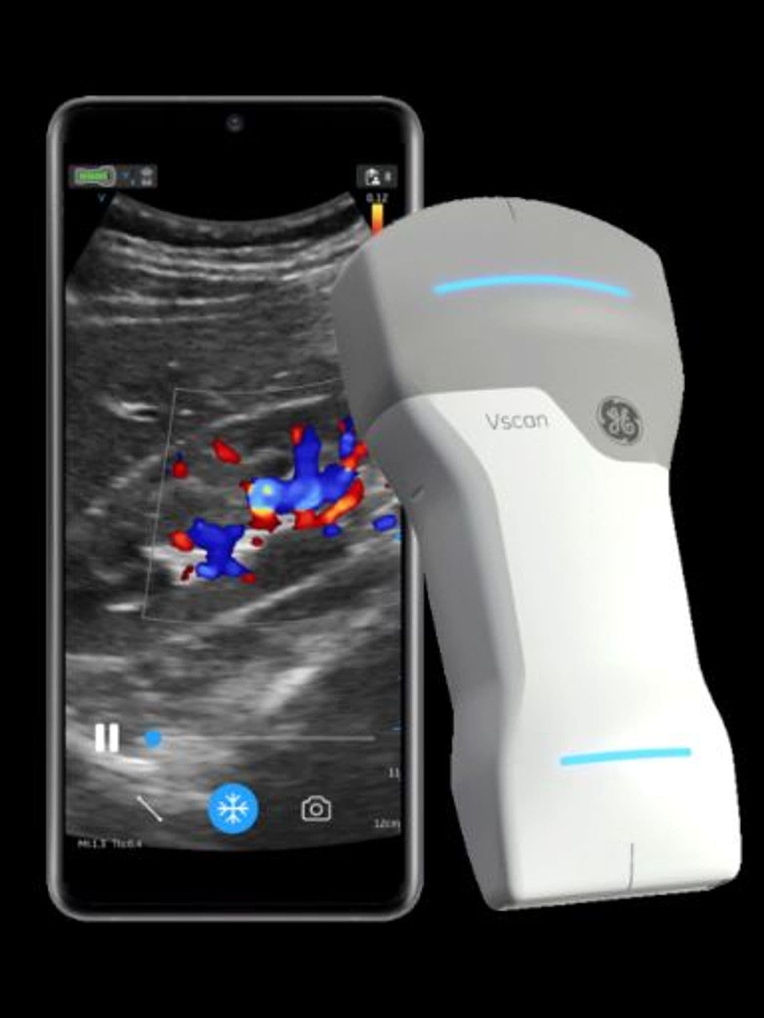 GE Vscan Air ultrasound system
