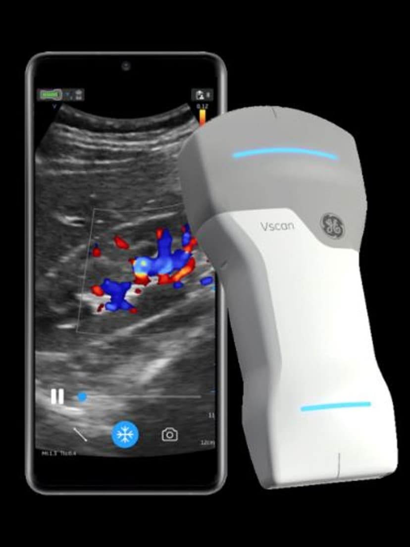 GE Vscan Air ultrasound system