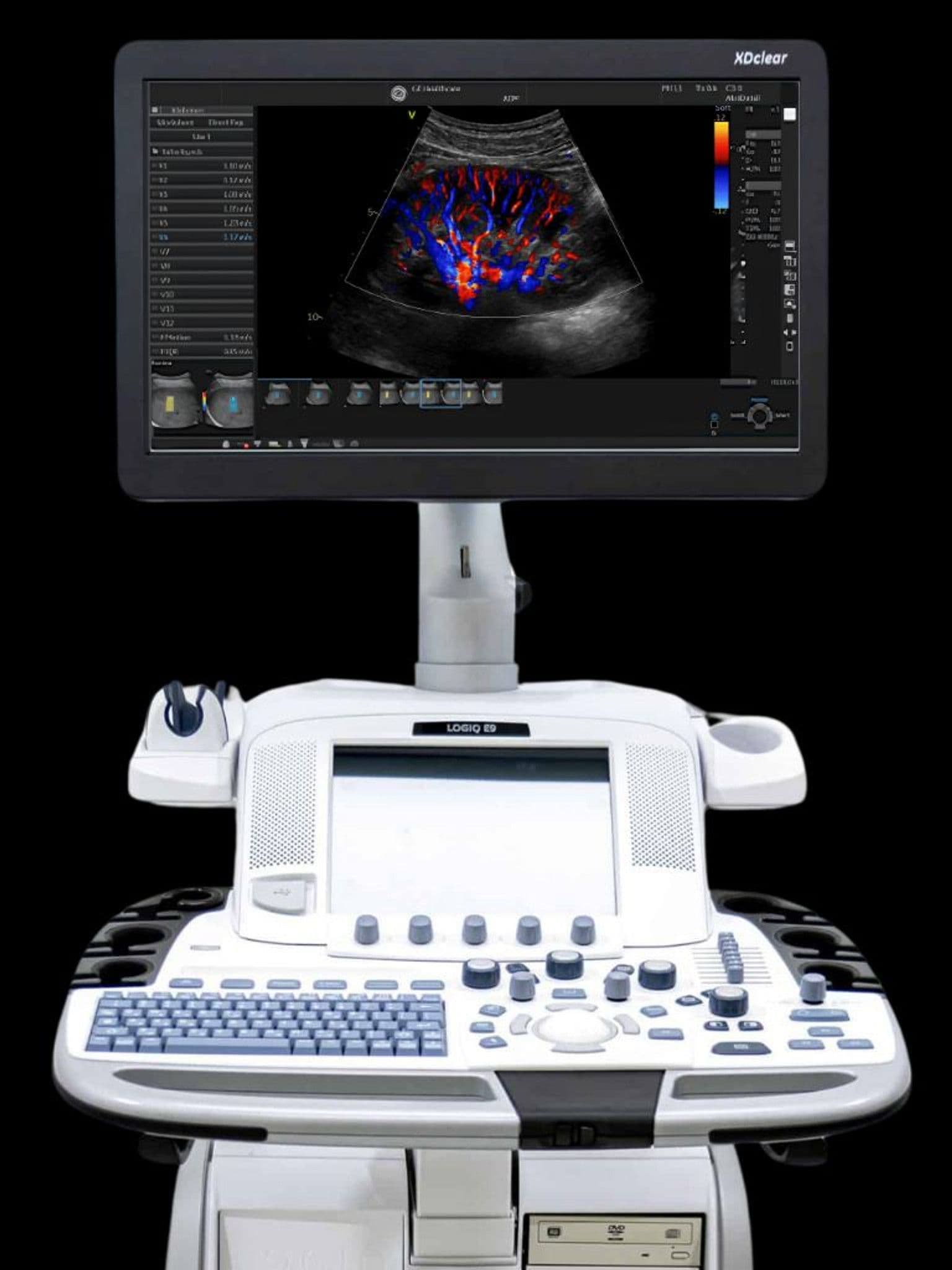 GE LOGIQ E9 ultrasound system