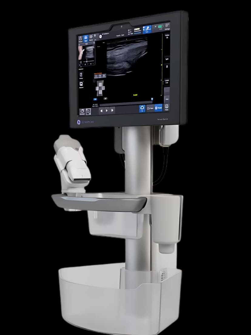 GE Venue Sprint ultrasound system
