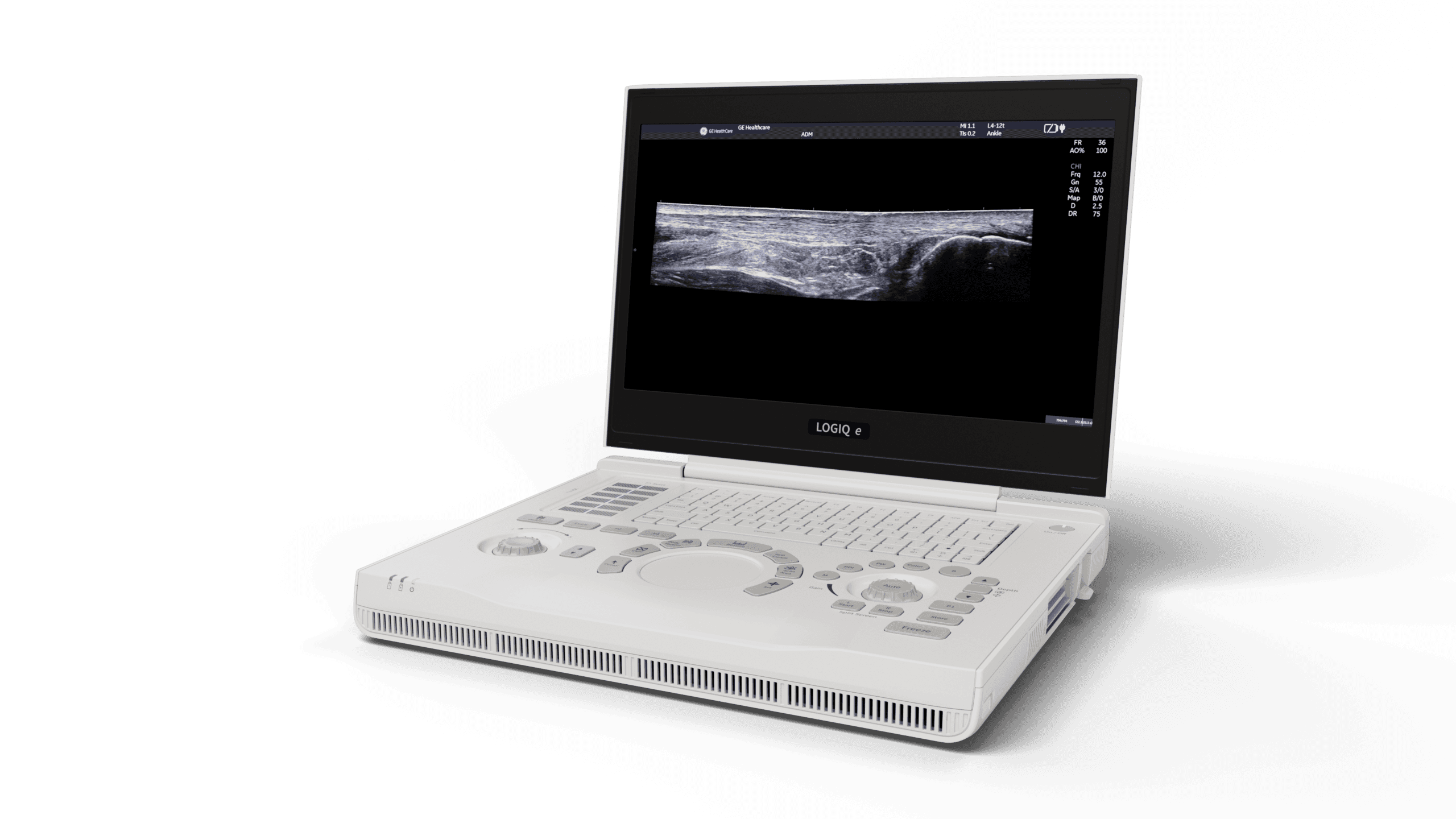 GE LOGIQ e R9 portable ultrasound, white laptop-style chassis with MSK image on the FHD display
