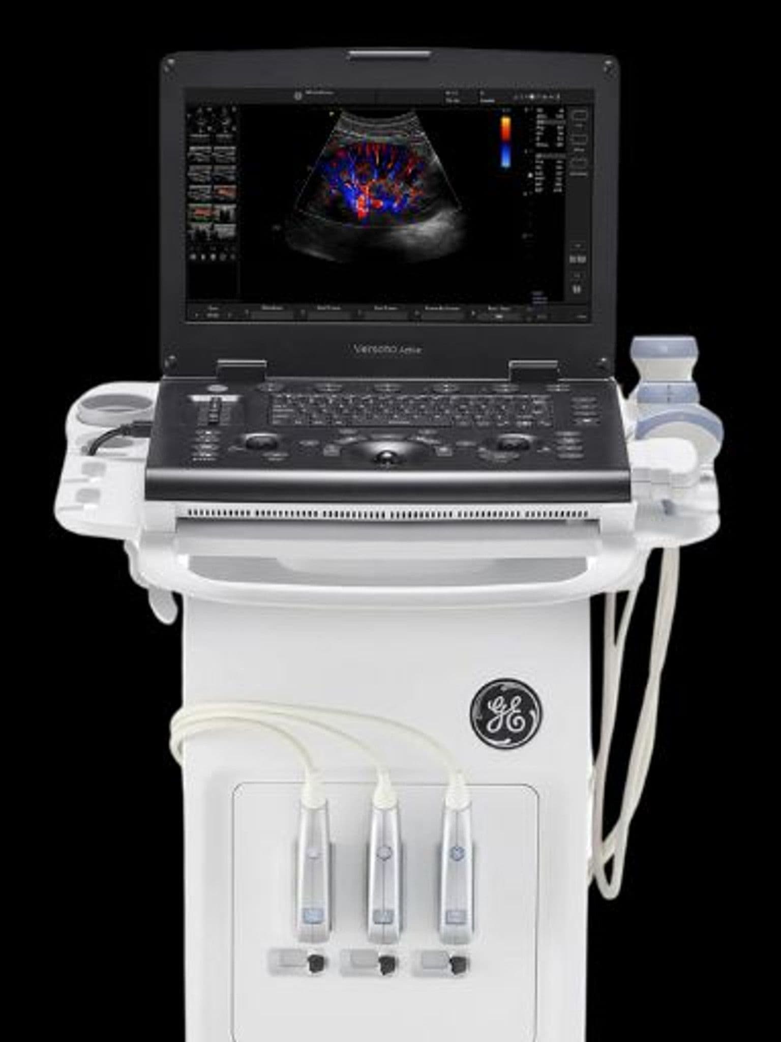 GE Versana Active ultrasound system