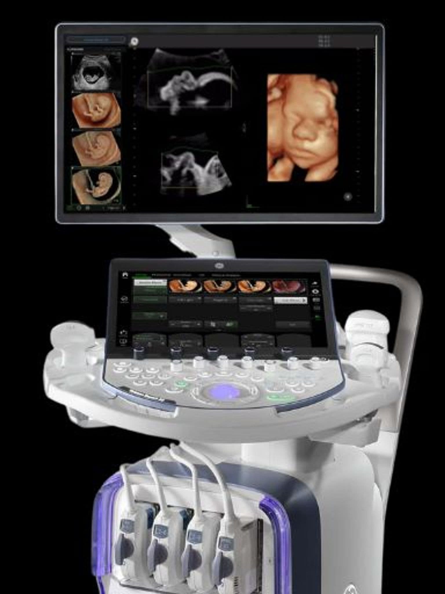 GE Voluson Expert 22 ultrasound system