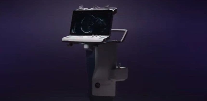 New Voluson: A "Swift" Change for Portable 3D4D Ultrasound