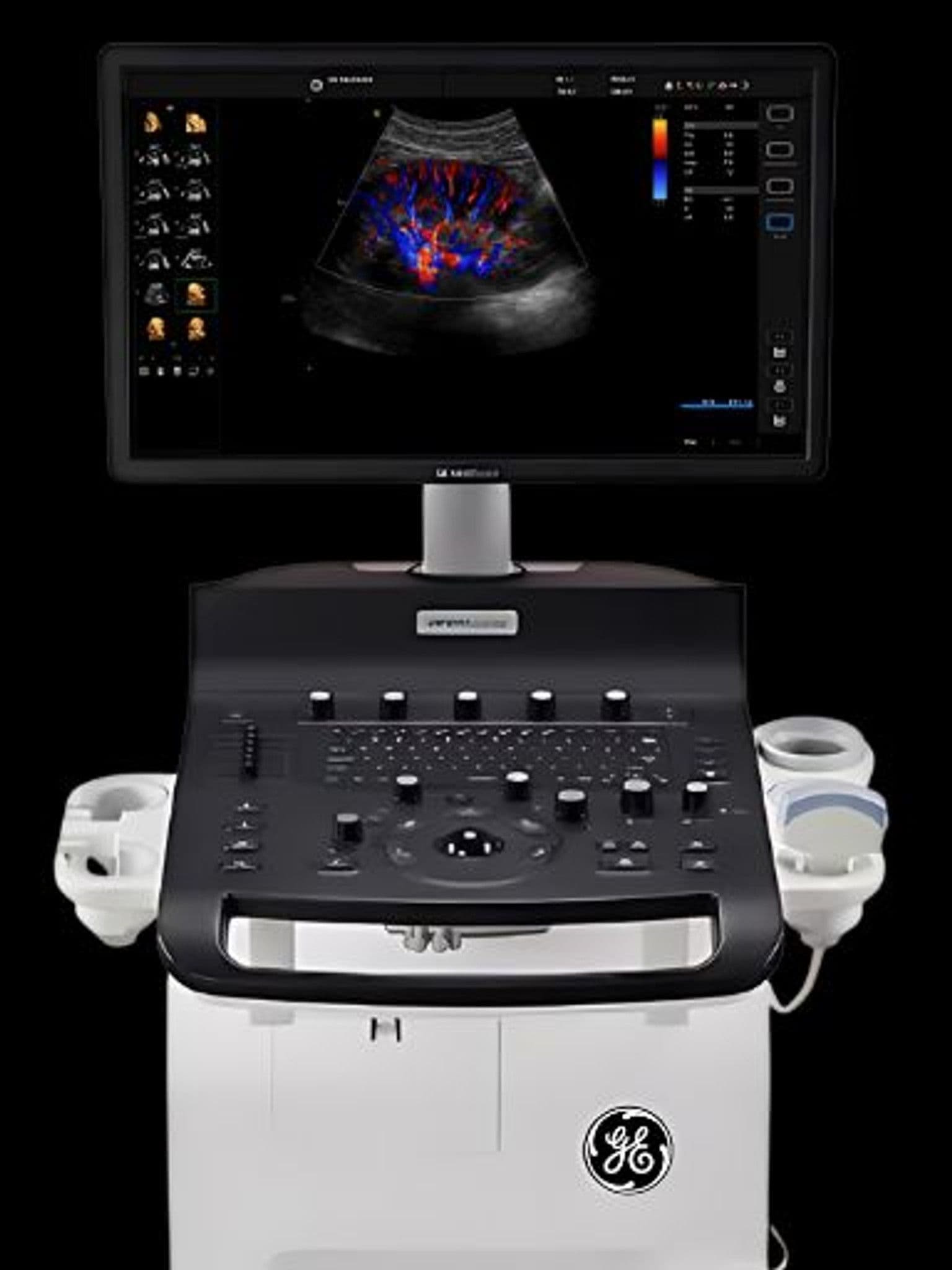 GE Versana Essential ultrasound system