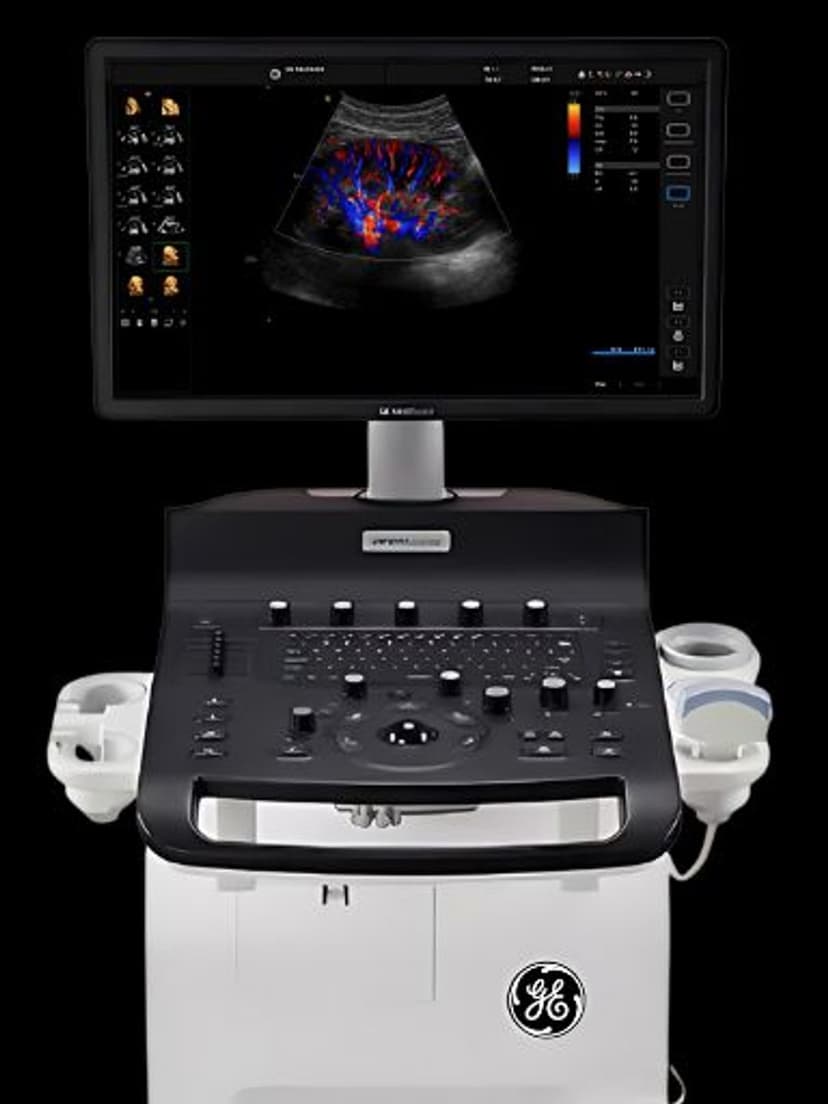 GE Versana Essential ultrasound system