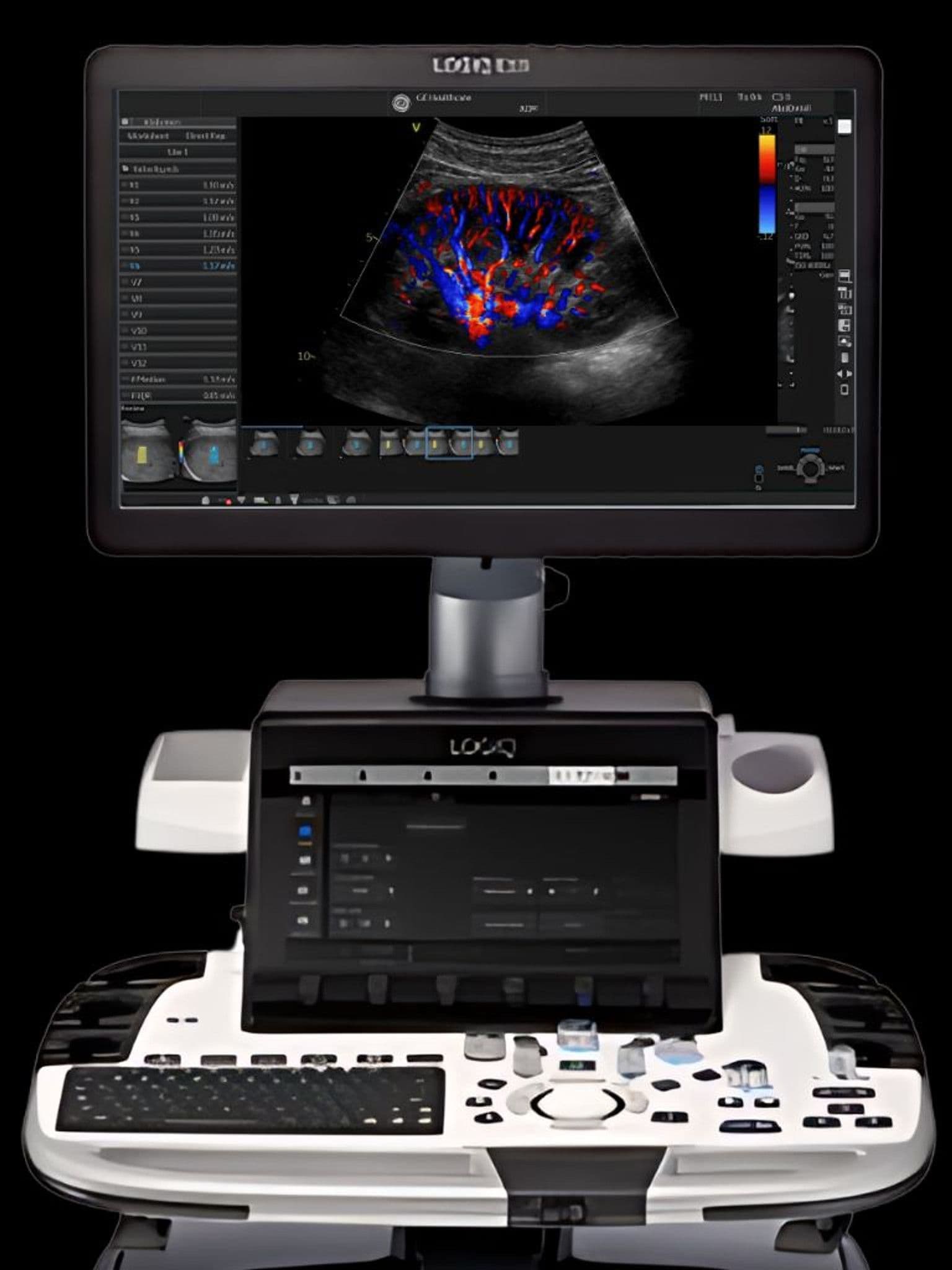 GE LOGIQ E10 ultrasound system