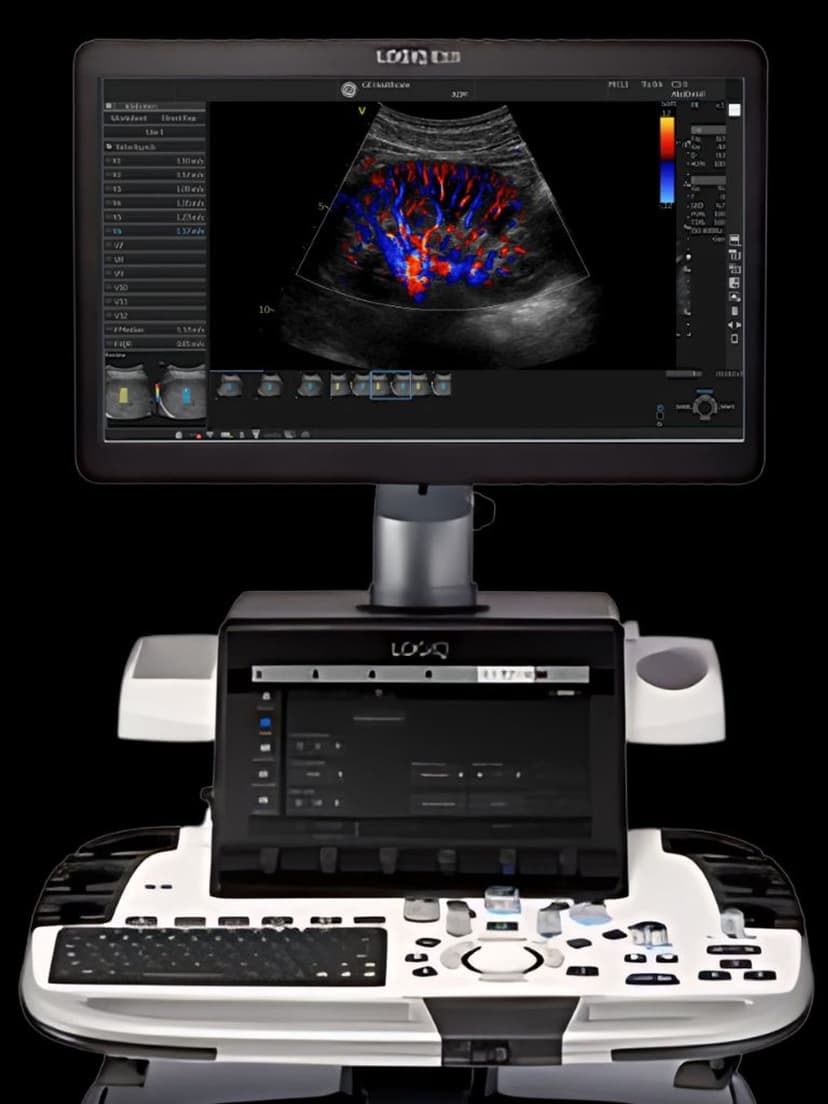GE LOGIQ E10 ultrasound system