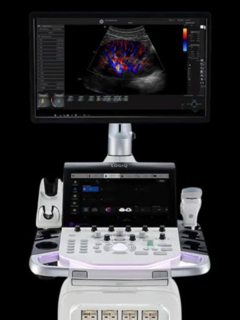 GE LOGIQ Totus ultrasound system