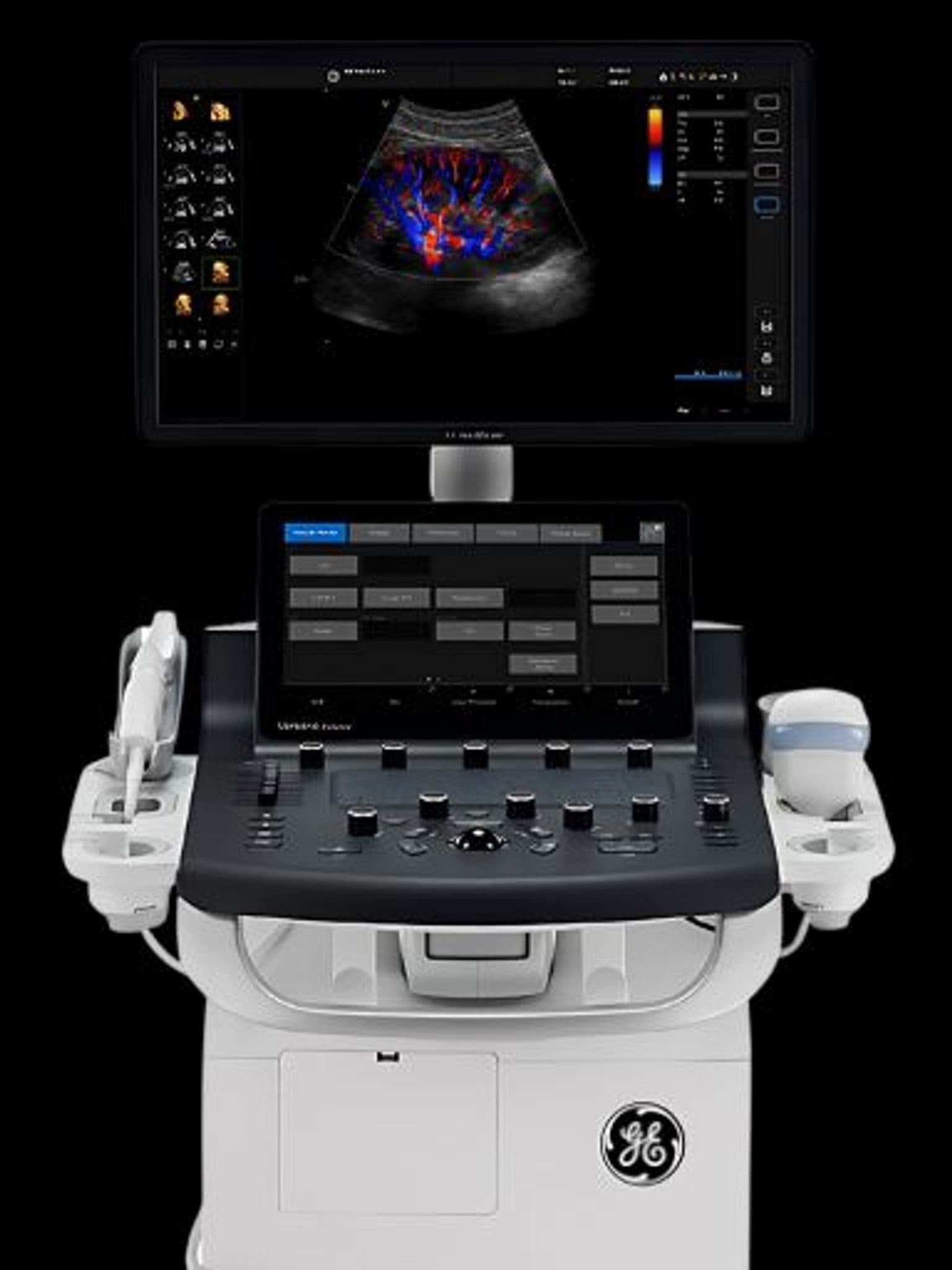 GE Versana Balance ultrasound system