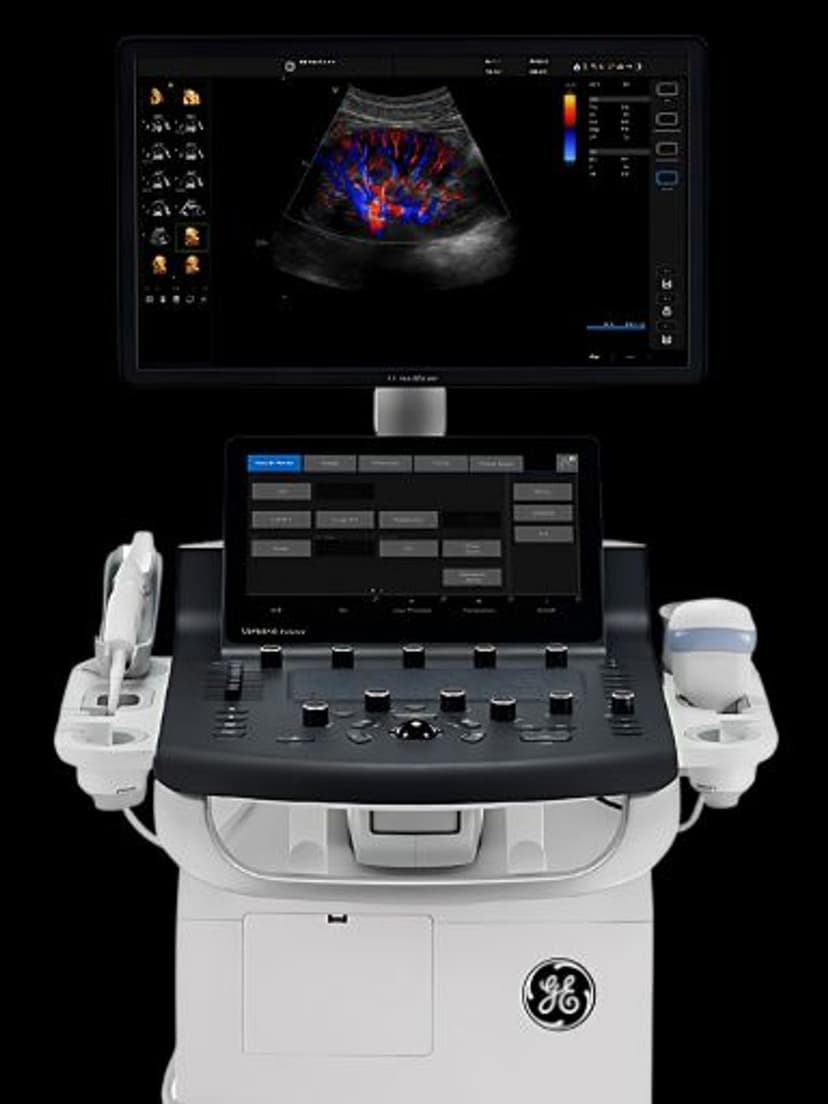 GE Versana Balance ultrasound system