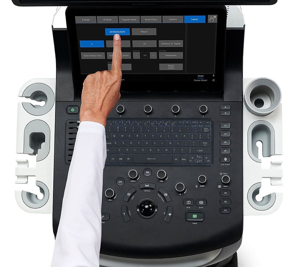 GE Versana Balance Ultrasound: Why Every Private Medical Office Will Have One