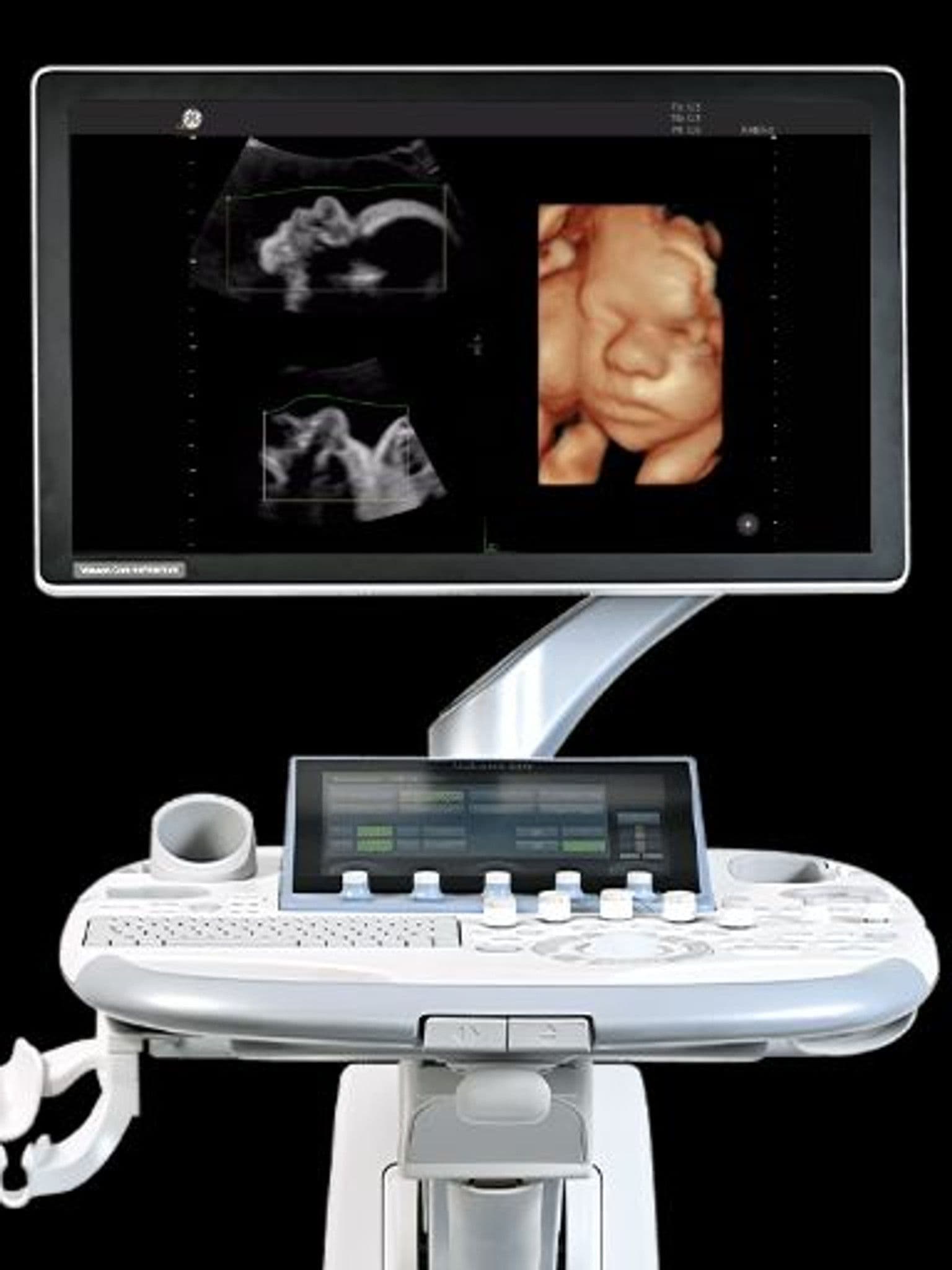 GE Voluson S10 Expert ultrasound system