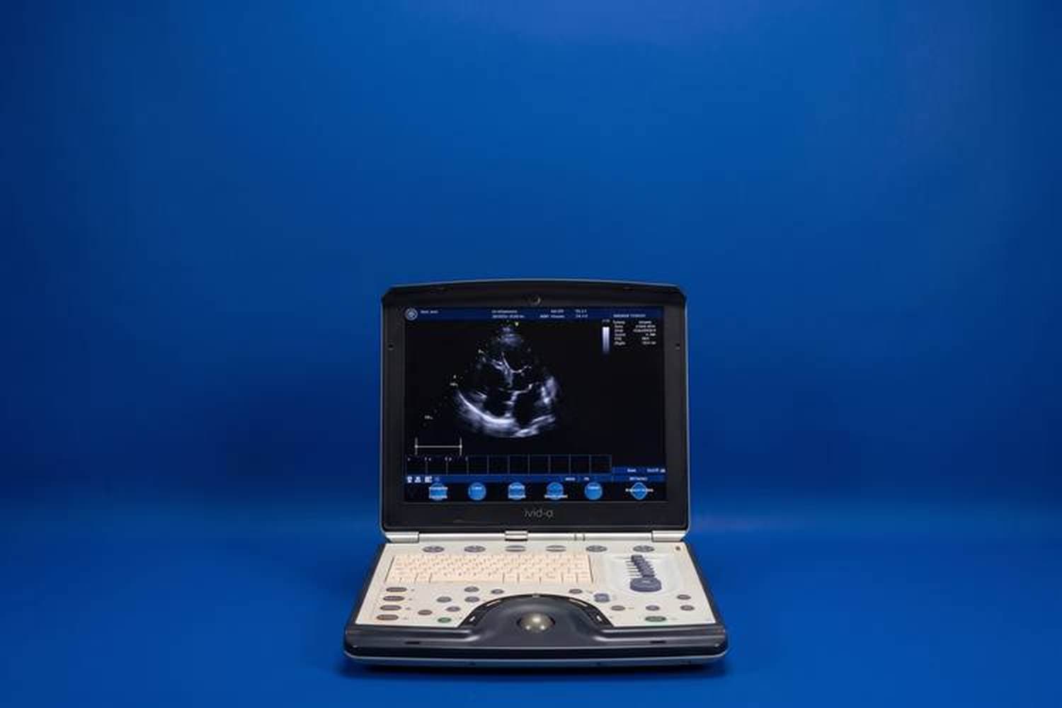 GE Vivid q ultrasound system
