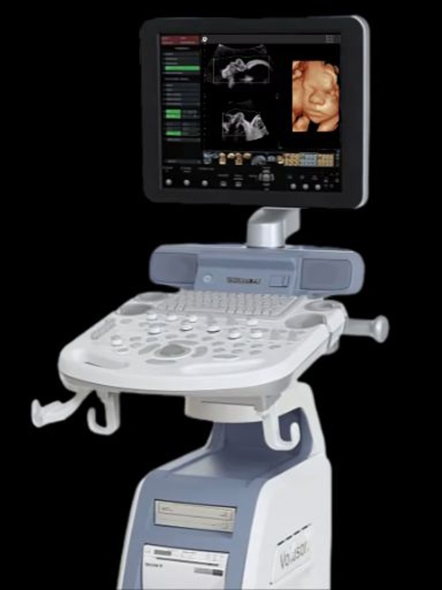 GE Voluson P8 ultrasound system