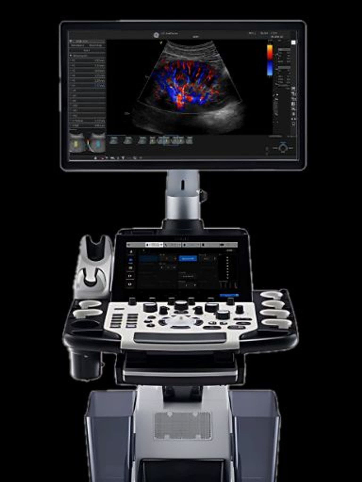 GE LOGIQ Fortis ultrasound system