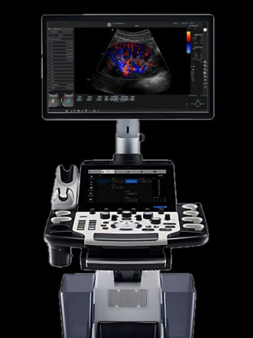 GE LOGIQ Fortis ultrasound system