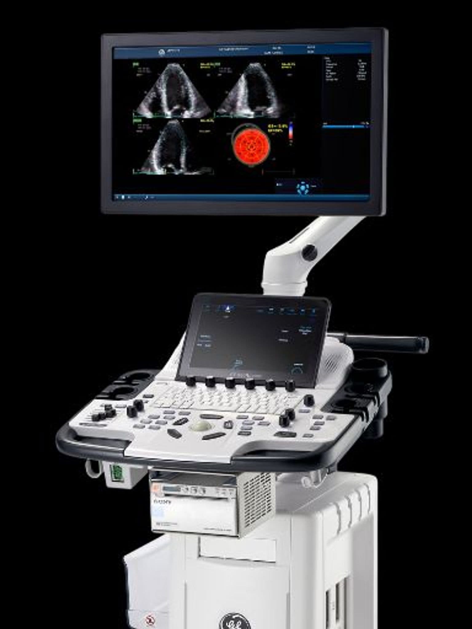 GE Vivid T9 cardiovascular ultrasound system with myocardial strain analysis on screen.