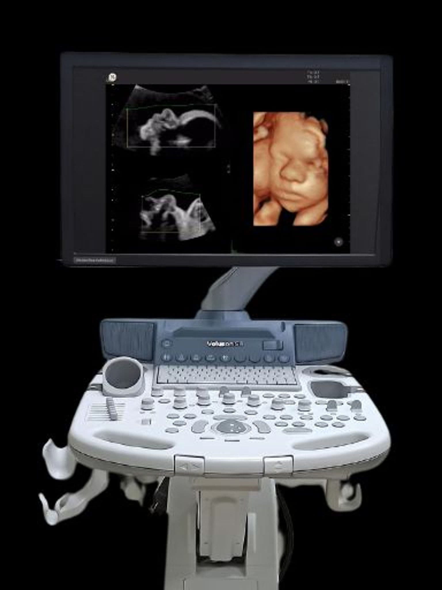 GE Voluson S8 ultrasound system