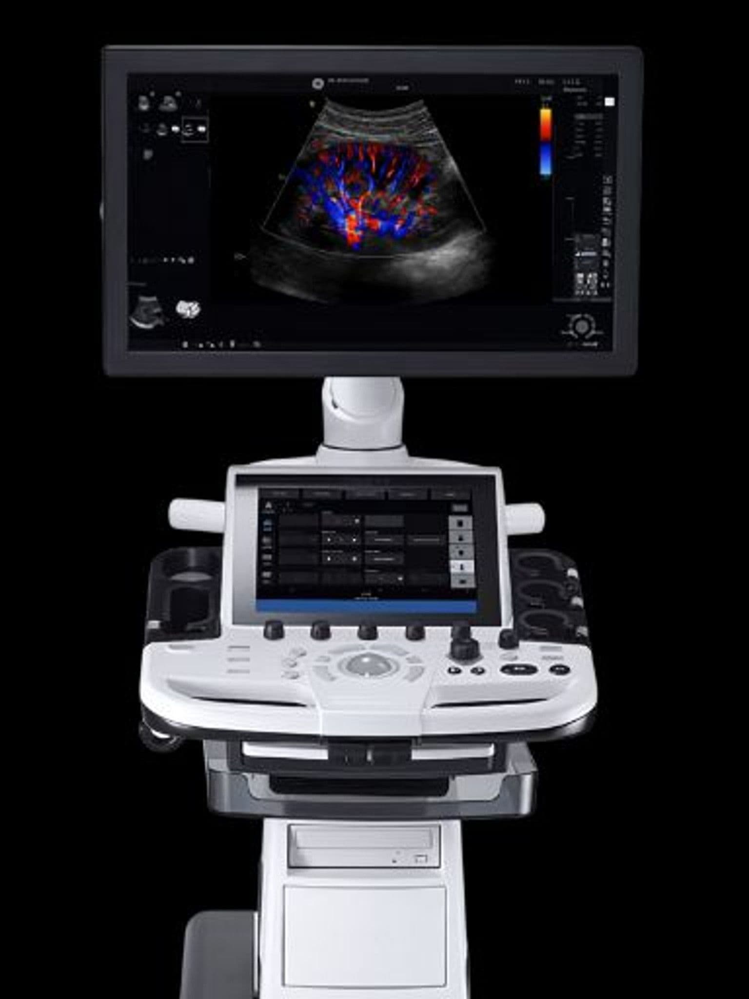 GE LOGIQ P10 ultrasound system
